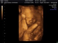 baby 4d scan 23+3 007.jpg