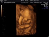 baby 4d scan 23+3 008.jpg