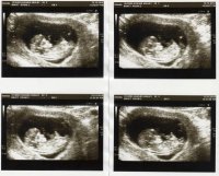 Baby Scan.jpg