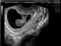 baby1.jpg