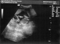 Baby.jpg