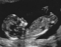 BabyMegan1_0003.jpg