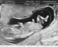 BabyMegan1_0001.jpg
