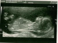 Boo 13 week scan jpeg.jpg