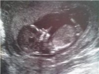 12 wk scan Baby no2.jpg