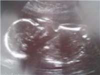 Baby 2 second scan.jpg