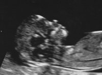 BabyMegan1.jpg