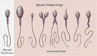sperm-morph.jpg