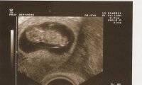 baby13jan.jpg