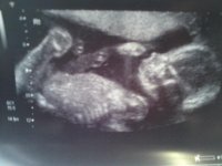 anomoly scan 1.jpg
