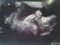 anomoly scan 2.jpg