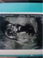 baby scan evans no.2 12 week.jpg