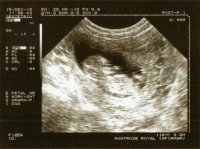 Scan2.jpg