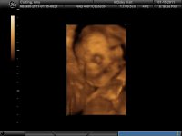 BABY_6.jpg