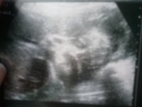 2011-01-17 11.46.10.jpg