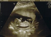 RVI Scan 1.jpg