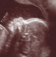 baby.jpg