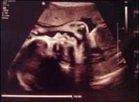 27weeks.jpg