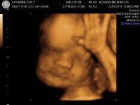 BABY_12.jpg