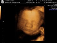 BABY_28.jpg