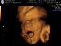 BABY_34.jpg