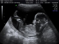 BABYBOND_3.jpg