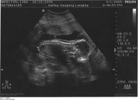 20 week ultrasound B&W.jpg