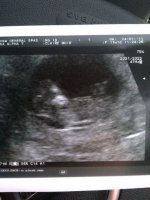 Baby noodles 11+1.jpg