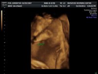 2011JAN25      ANDERSON BABY_1_13.jpg