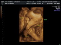2011JAN25      ANDERSON BABY_1_31.jpg