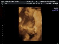 2011JAN25      ANDERSON BABY_1_35.jpg