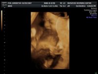 2011JAN25      ANDERSON BABY_1_39.jpg