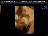 2011JAN25      ANDERSON BABY_1_44.jpg