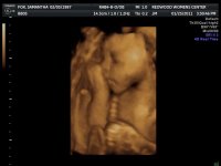 2011JAN25      ANDERSON BABY_1_66.jpg