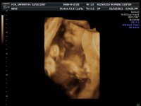 2011JAN25      ANDERSON BABY_1_70.jpg