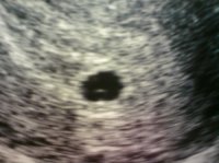 5+2 scan.jpg