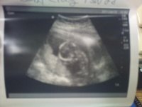 profile baby 15 weeks 2 days.jpg