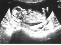 baby sweet.jpg