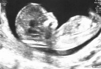 baby 2.jpg