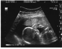 20110128 - Baby Spencer 4.jpg