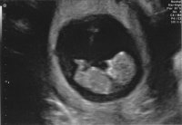 110128 Eva's first.jpg