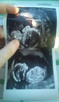 18weeks5days.jpg