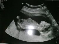 310120111301.jpg