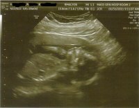 baby19wks2.jpg