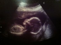 bub4.jpg