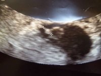 scan2.jpg