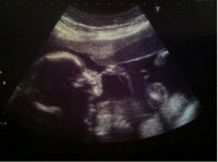 bub4.1.jpg