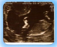 12wk 7days scan3.jpg