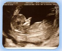 12wk 7days scan2.jpg