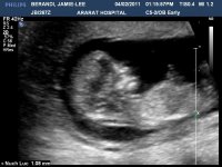 BERANDIJAMIE-LEE20110204131557895.jpg
